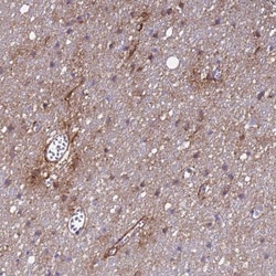 P2X7/P2RX7 Antibody, Novus Biologicals 0.1mL; Unlabeled:Antibodies, Polyclonal